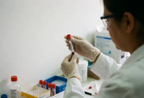 Medical professional in a clinical lab wearing safety gear while holding a blood collection tube against a clean white background.
