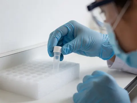 Close-up of a blue gloved hand carefully placing a medical sample vial into a white foam holder in a clean laboratory setting