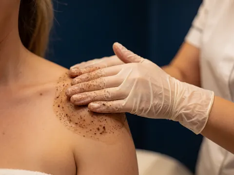 A gloved hand applies a cocoa exfoliating scrub to a person's shoulder against a dark blue background in a professional aesthetic setting.