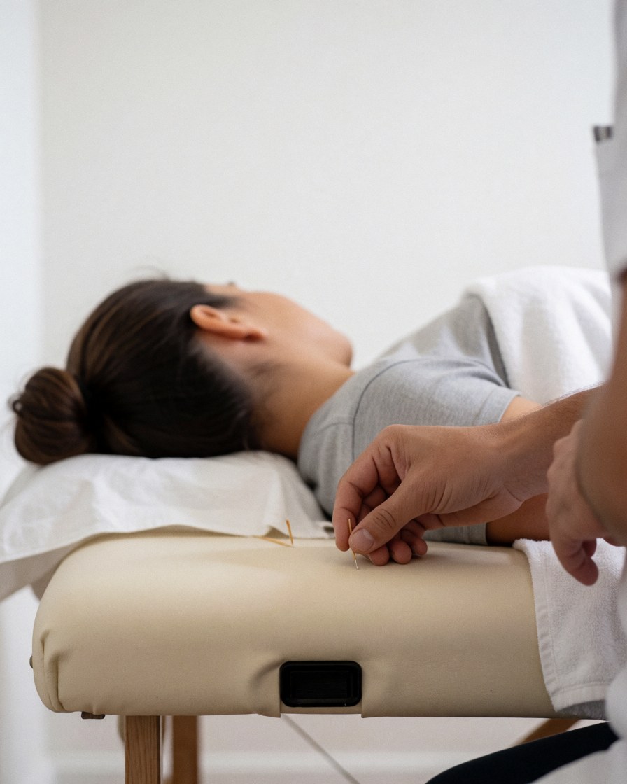 A relaxed patient lying on a treatment table receiving acupuncture therapy with thin needles inserted for wellness and healing