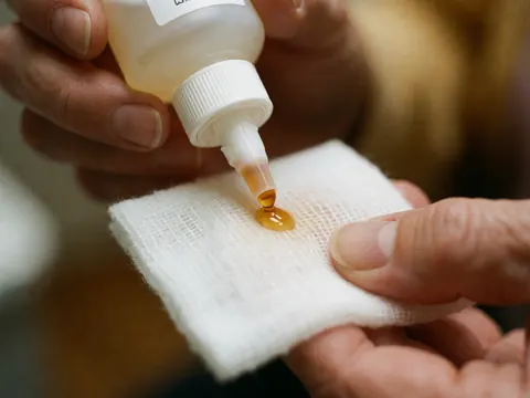 A drop of povidone iodine antiseptic falls onto white sterile gauze held by adult hands, with a blurred background and natural lighting, suitable for podiatry and wound care.