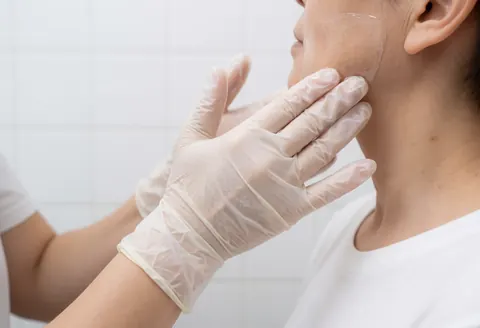 A gloved hand applies therapeutic gel to a client's chin area against a white tiled background.