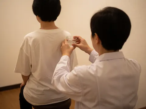 Therapist in white coat using glass cup for cupping therapy on client's shoulder in calm room with warm light